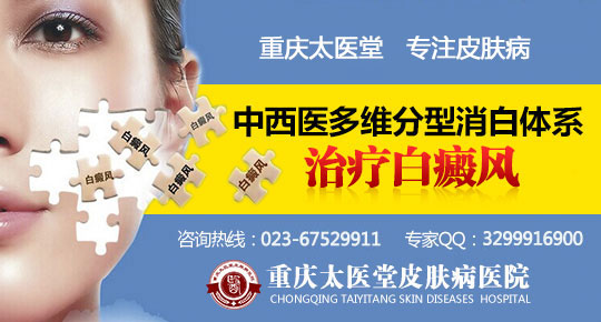 温州华医堂治疗白癜风